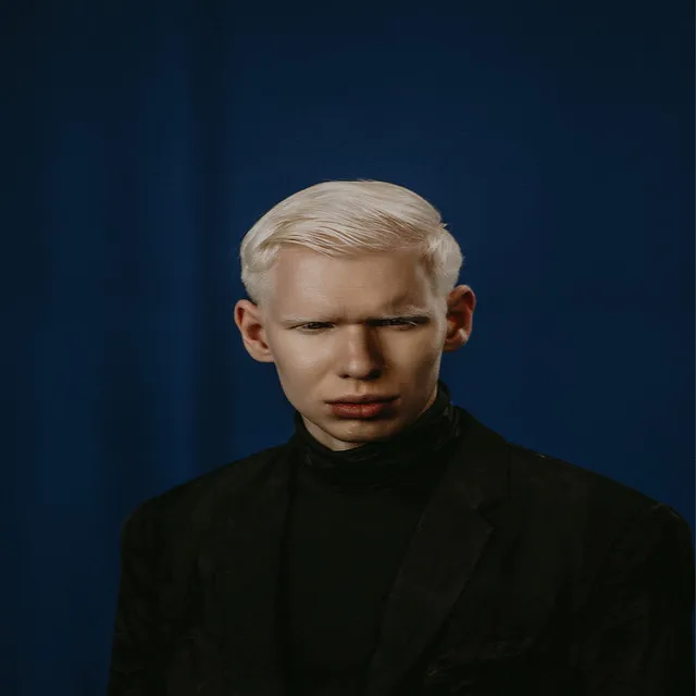 Albino