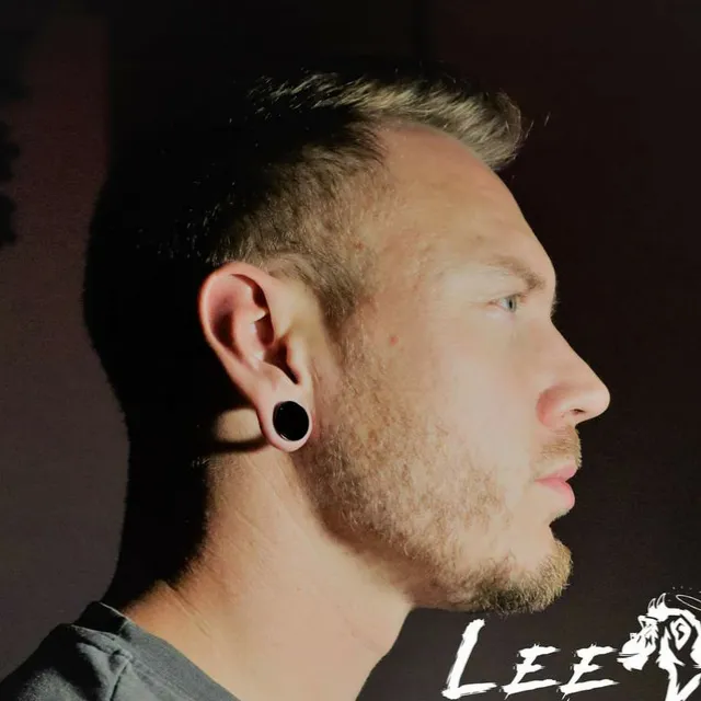 Lee Severe