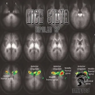 Bipolar by Nick Silva