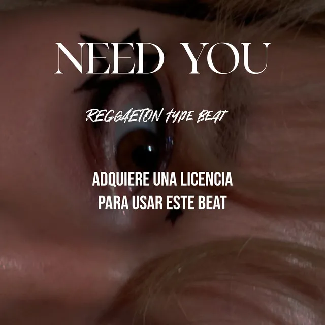 NEED YOU