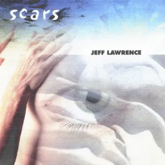 Scars by Jeff Lawrence