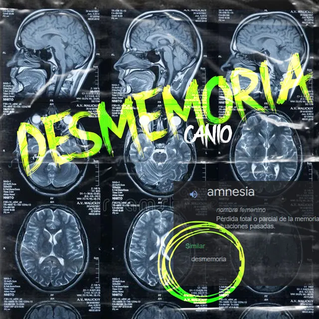 Desmemoria (Pre-Amnesia)