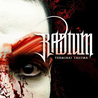 Terminal Trauma by Radium