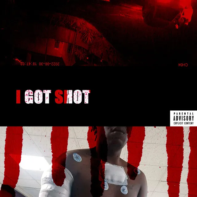 I GOT SHOT