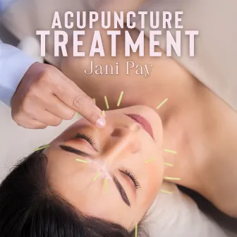 Acupuncture Treatment by Jani Pay