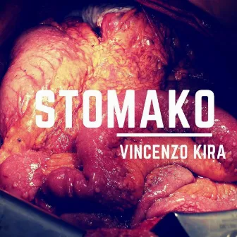 Stomaco by Vincenzo Kira