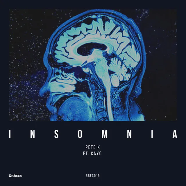 Insomnia - Radio Edit