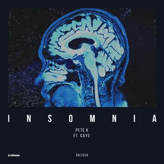 Insomnia (Radio Edit) by Pete K