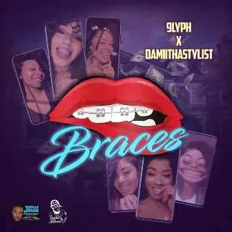 Braces by 9lyph