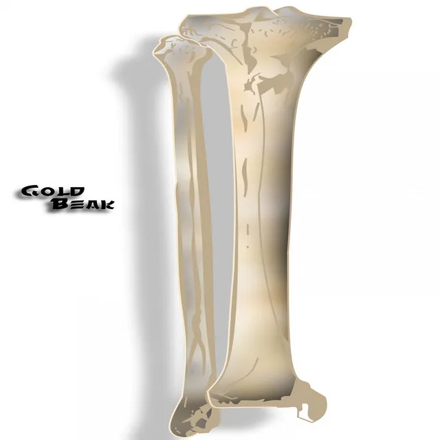 Open Fracture Of The TIbia 2