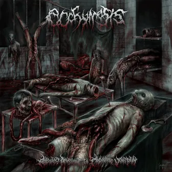 Aberrant Amusement In Cadaveric Vomitplay by Ecchymosis