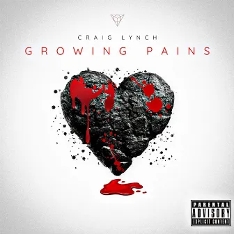 Growing Pains by Craig Lynch