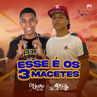 Esse É os 3 Macetes by DJ JOÃO DA 5B