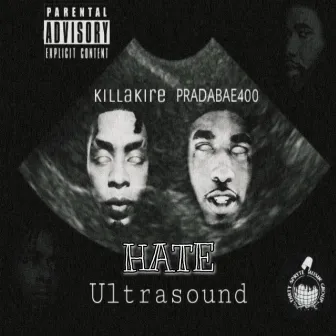 Hate by Killa Kire