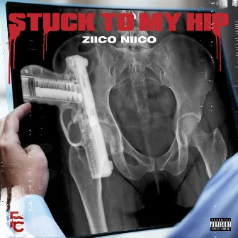 Stuck to My Hip by Ziico Niico