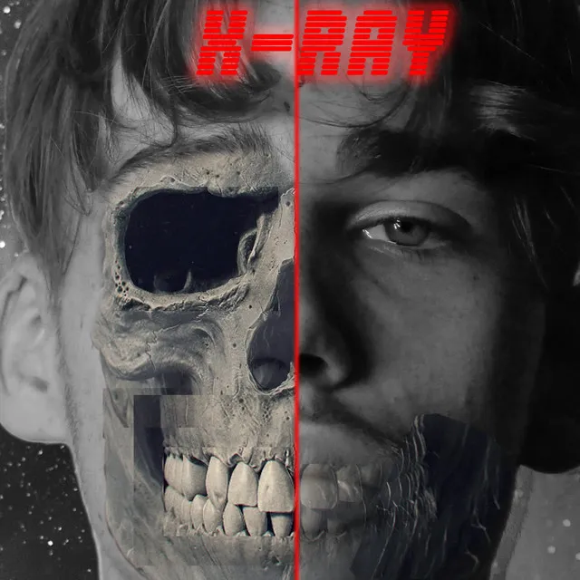 X-RAY