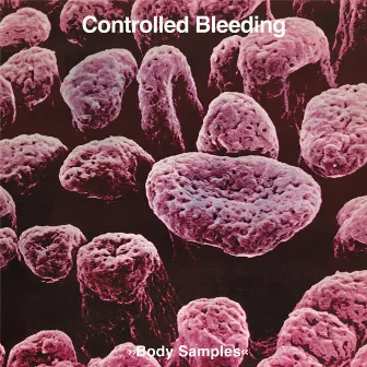 Body Samples by Controlled Bleeding