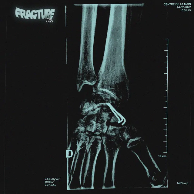 Fracture