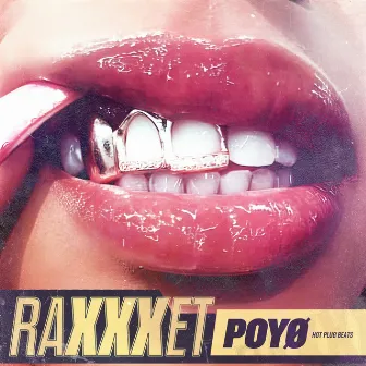 RaXXXet by Unknown Artist