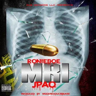 MRI (feat. JPaq) by RonieBoe