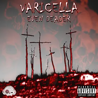 Even Deader by Varicella