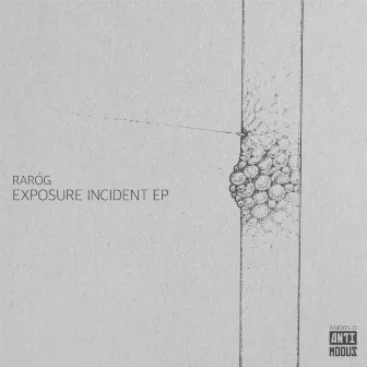 Exposure Incident EP by RARÓG