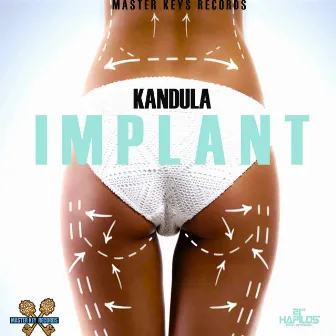 Implant - Single by Kandula