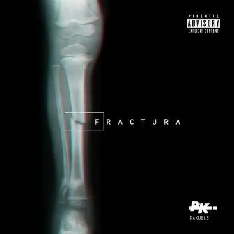 Fractura by Pakuels