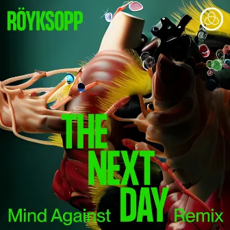 The Next Day (Mind Against Remix) by Mind Against