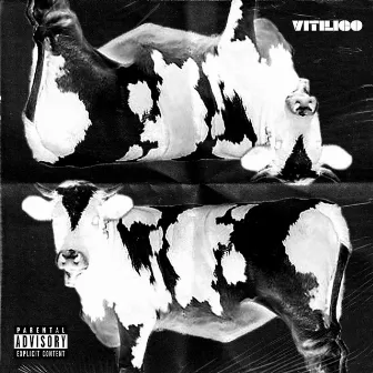 Vitiligo by Oveit