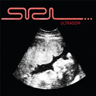 Ultrasom by siri