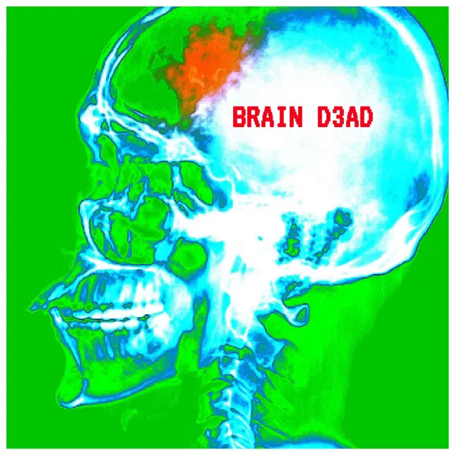 Brain D3ad