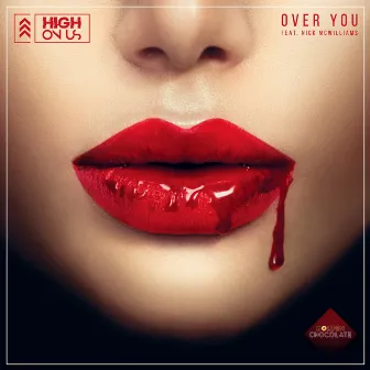 Over You by High On Us