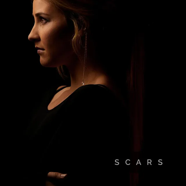 Scars