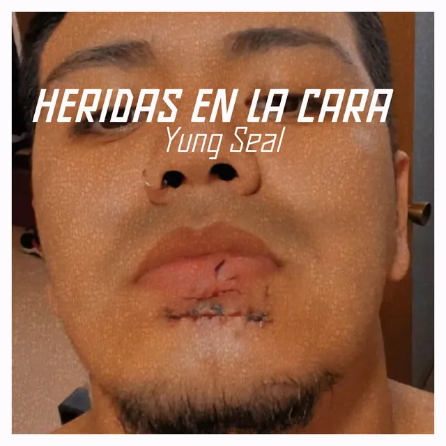 Heridas en la Cara