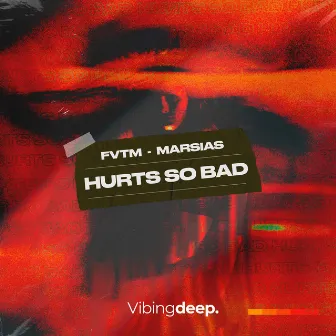 Hurts So Bad by Marsias