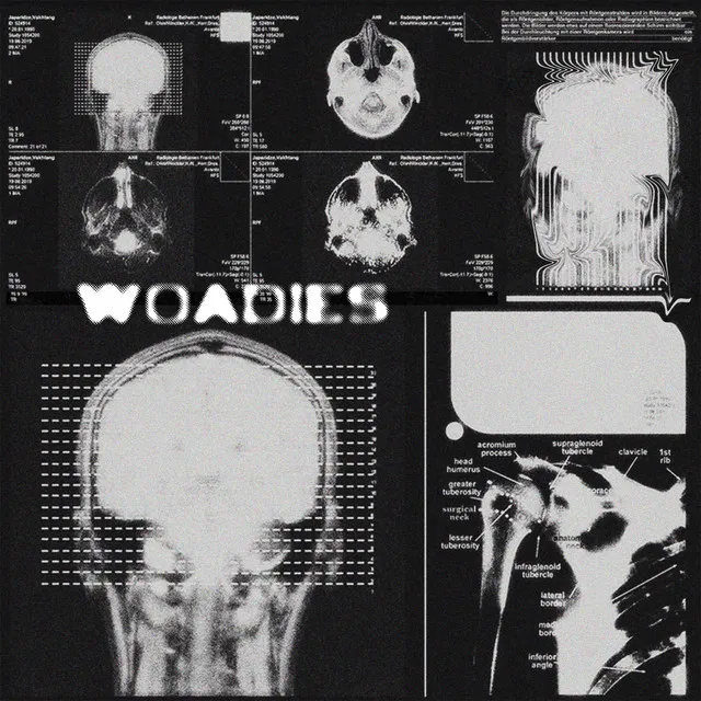 woadies