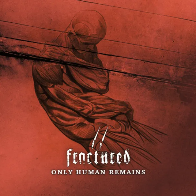 Only Human Remains