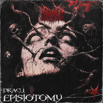 Episiotomy by DRACU