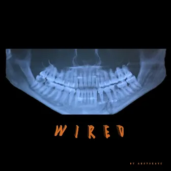 Wired by Andygrave