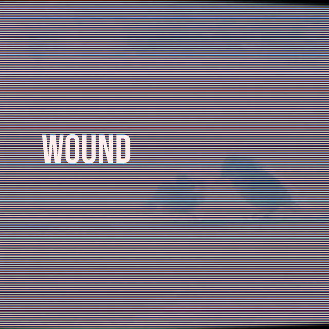 Wound