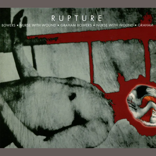 Rupture