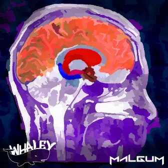 Moderate Stimulation (Whaley Remix) by Malgum