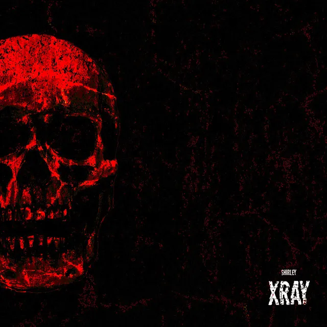 X-Ray