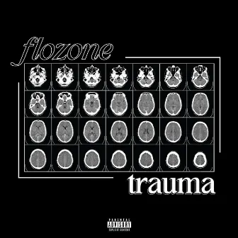 Trauma by Flozone