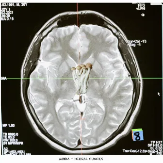 Neural Fungus by MOXHA