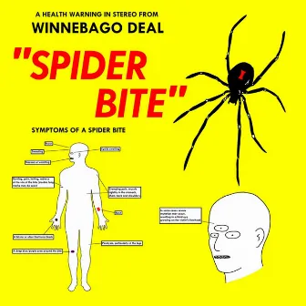 Spider Bite by Winnebago Deal