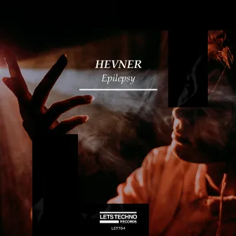 Epilepsy by HEVNER