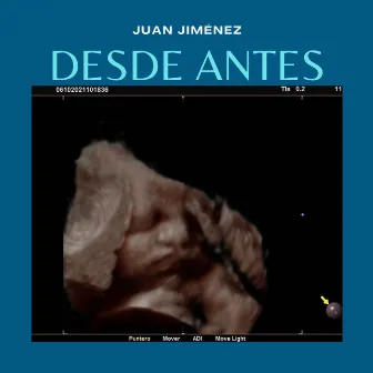 Desde Antes by Juan Jimenez