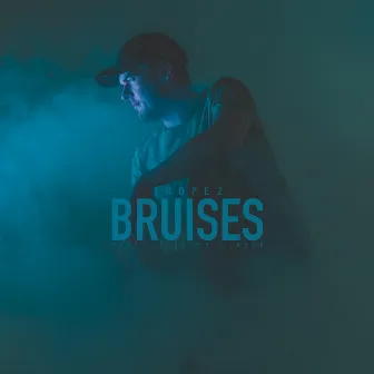 Bruises by Juliette Claire